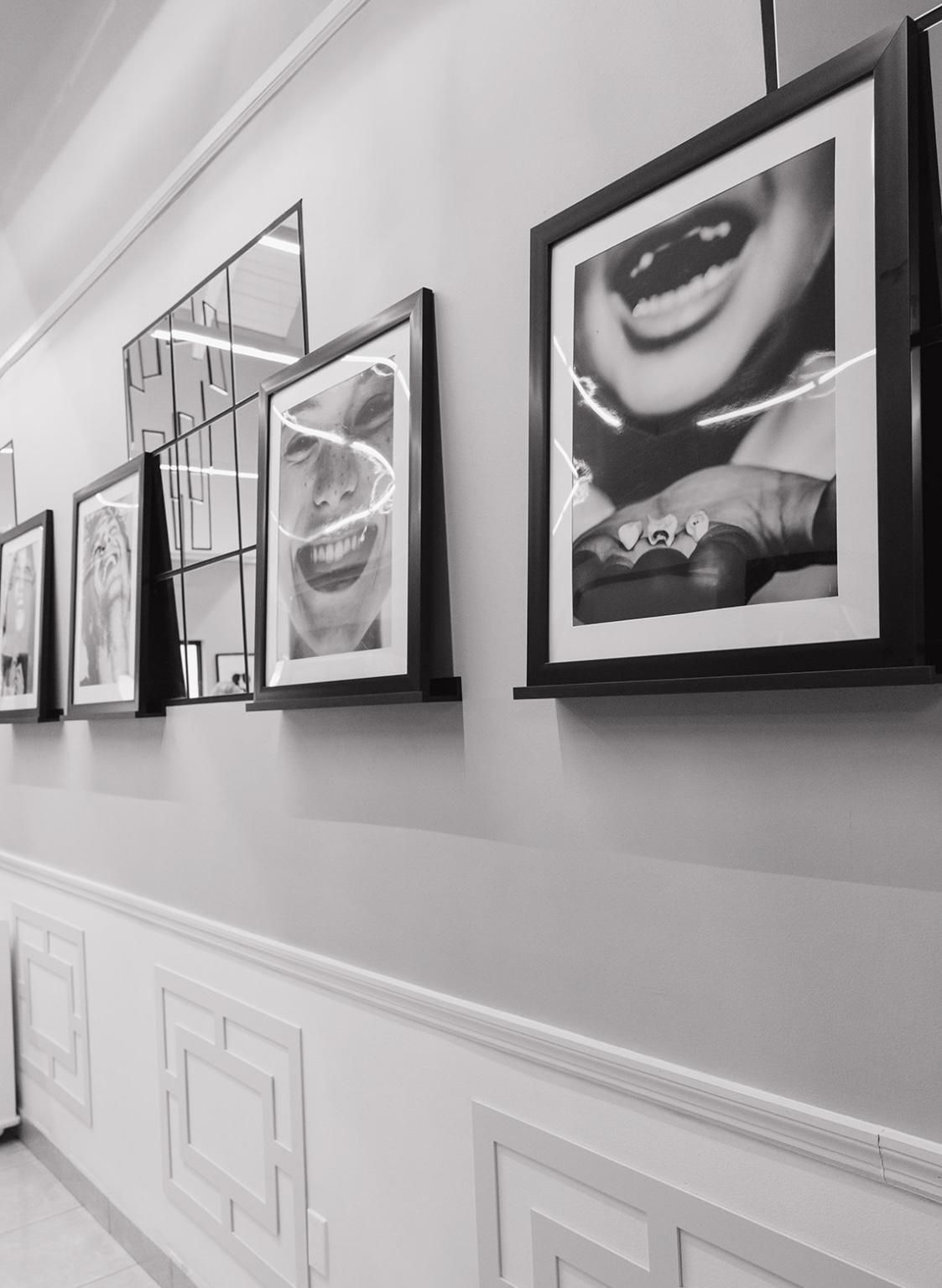 Anelisse Aesthetic Dental Design | Hollywood Porcelain Veneer Smile Transformations, Invisalign reg  and Professional In-Office Teeth Whitening