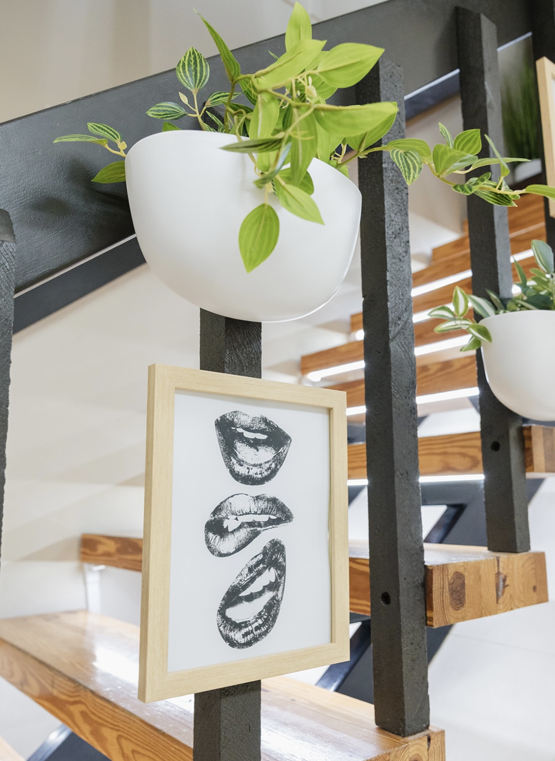 Anelisse Aesthetic Dental Design | Juvederm reg    Dermal Fillers, Invisalign reg  and Cosmetic Smile Makeover