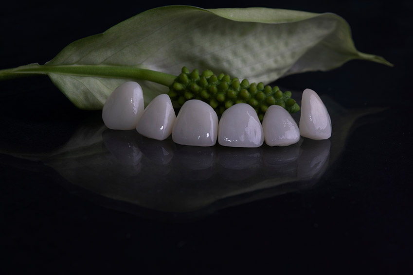 The image features a set of white porcelain teeth with visible chip details placed on a dark surface next to a green plant with small leaves, creating a contrast between man-made dental implants and natural flora.