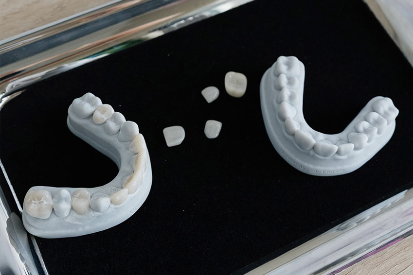 The image shows a row of white dental implants placed on a green leafy plant.