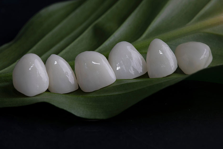 The image shows a collection of white dental implants with a reflective surface, arranged on a dark background with a leafy plant visible at the bottom.
