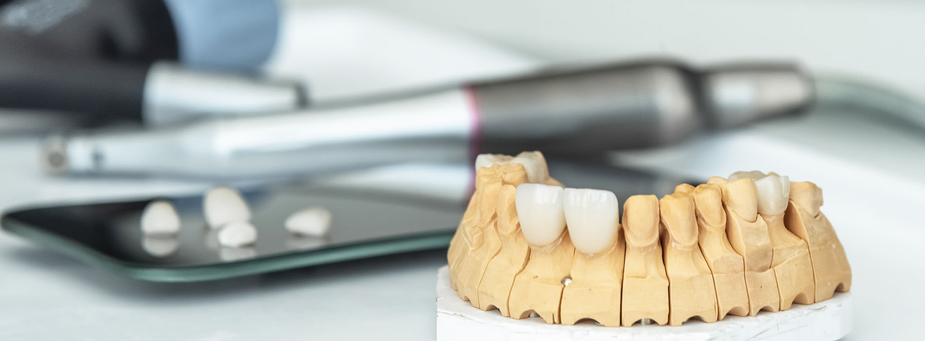 The image shows a collection of dental implants with various shapes and sizes displayed on a table, along with some tools commonly used in dental procedures.