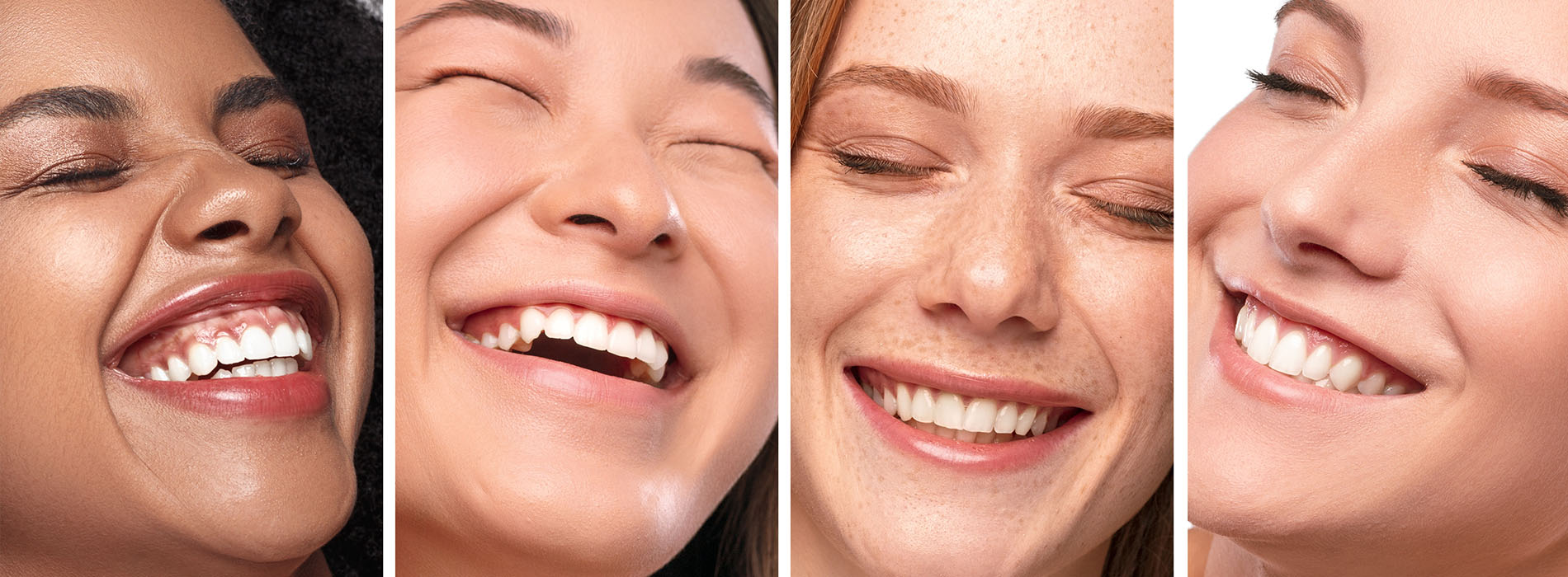 The image displays a collage of six different individuals with smiles on their faces, showcasing a variety of ethnicities and skin tones.