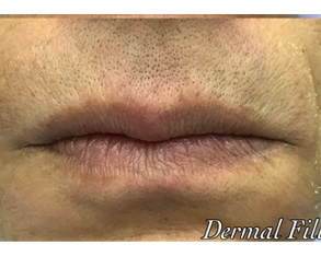 The image shows a close-up of a person's face with a focus on their lips and facial hair, featuring text overlaying the image.