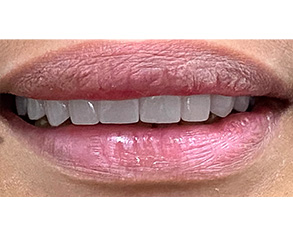 The image shows a close-up view of a person's lips with lipstick applied, against a white background with a black bar at the bottom.