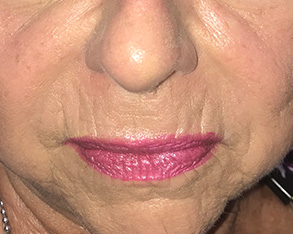 The image shows a close-up of a person's face with prominent pink lipstick, focusing on their lips and facial features.