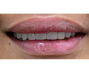 The image shows a close-up of a person s lips with lipstick applied, set against a plain background.