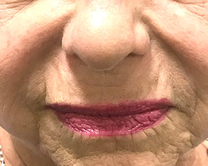 A close-up photograph of an elderly person with prominent red lipstick and makeup around the lips and nose, wearing a creamy foundation and displaying a neutral expression.