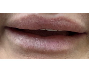 Alt text: Image features a close-up of a person's lips with a noticeable lipstick smudge, set against a background that includes a barcode-like pattern.