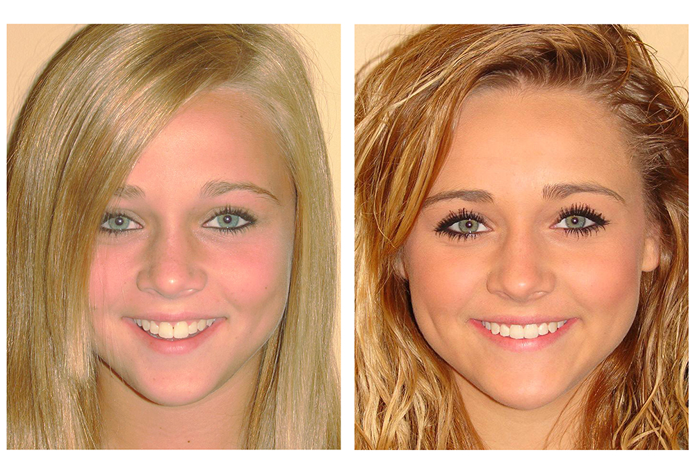 Anelisse Aesthetic Dental Design