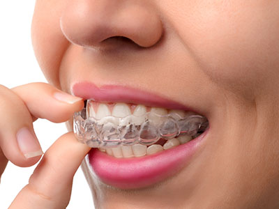 The image shows a person with braces, adjusting them with their hands, while looking directly at the camera.